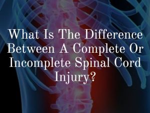 What Is The Difference Between A Complete Or Incomplete Spinal Cord ...